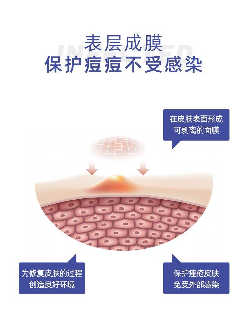 表层成膜 保护痘痘不受感染 在皮肤表面形成 可剥离的面膜 品9 为修复皮肤的过程 保护痤疮皮肤 创造良好环境 免受外部感染 