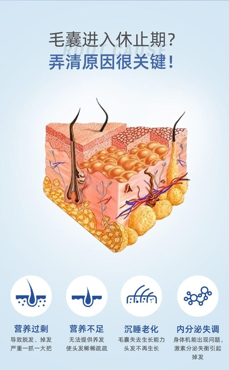 毛囊进入休止期? 弄清原因很关键! L U :.:: 营养过剩 营养不足 沉睡老化 内分泌失调 导致脱发、掉发 无法提供养发 毛囊失去生长能力 身体机能出现问题, 严重一抓一大把 使头发稀稀疏疏 头发不再生长 激素分泌失衡引起 掉发 