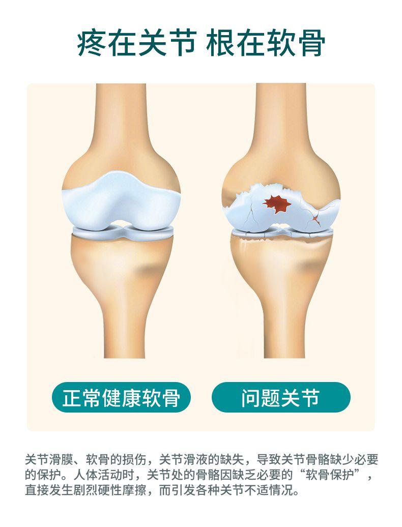 疼在关节根在软骨 正常健康软骨 问题关节 关节滑膜、软骨的损伤,关节滑液的缺失,导致关节骨骼缺少必要 的保护。人体活动时,关节处的骨骼因缺乏必要的“软骨保护” 直接发生剧烈硬性摩擦,而引发各种关节不适情况。 