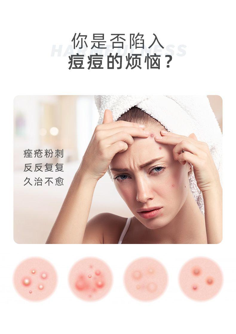 你是否陷入 H SS 痘痘的烦恼? 痤疮粉刺 反反复复 久治不愈 